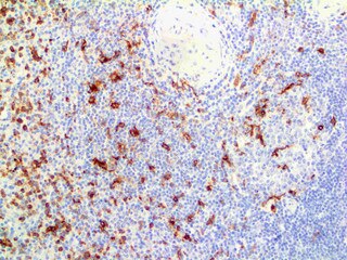 IHC of CD13 on an FFPE Tonsil Tissue